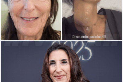 🌈 – Paz Padilla ha logrado decir adiós a sus arrugas del rostro con el tratamiento más top