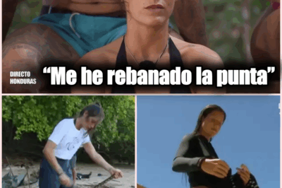 Miri Pérez-Cabrero Sufre Accidente en ‘Supervivientes All Stars 2’ y Enfrenta el Dolor con Humor y Valentía